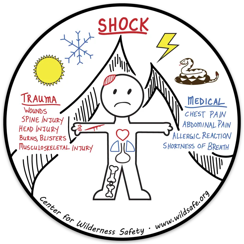Causes Of Shock Educational Vinyl Decal 1